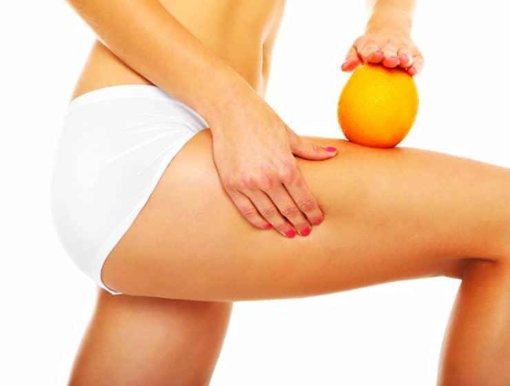 7 Tipps gegen Cellulite